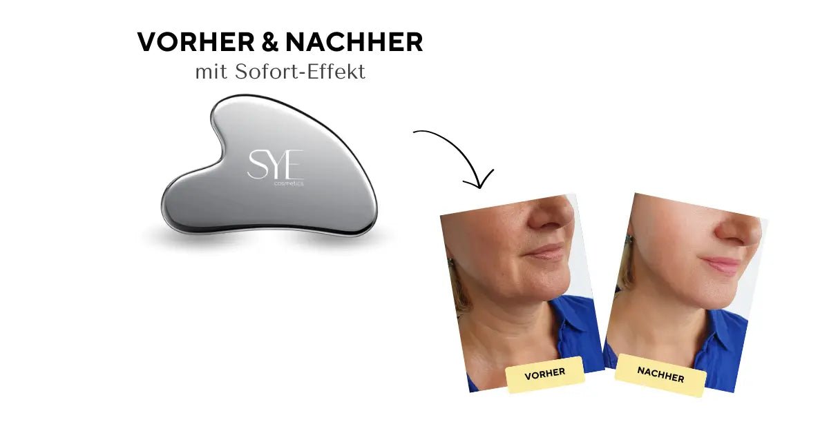 Gua Sha vorher nachher